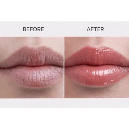 Marble Lip Combo – Soft Marble